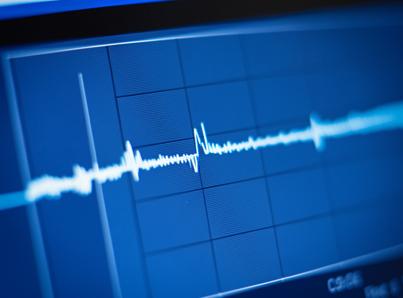 Close-up of a computer screen showing a ping latency graph in milliseconds with a small spike